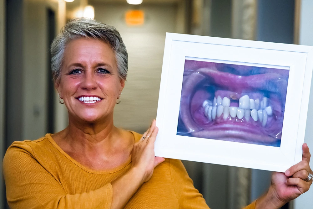 implantbaoldshootrobin