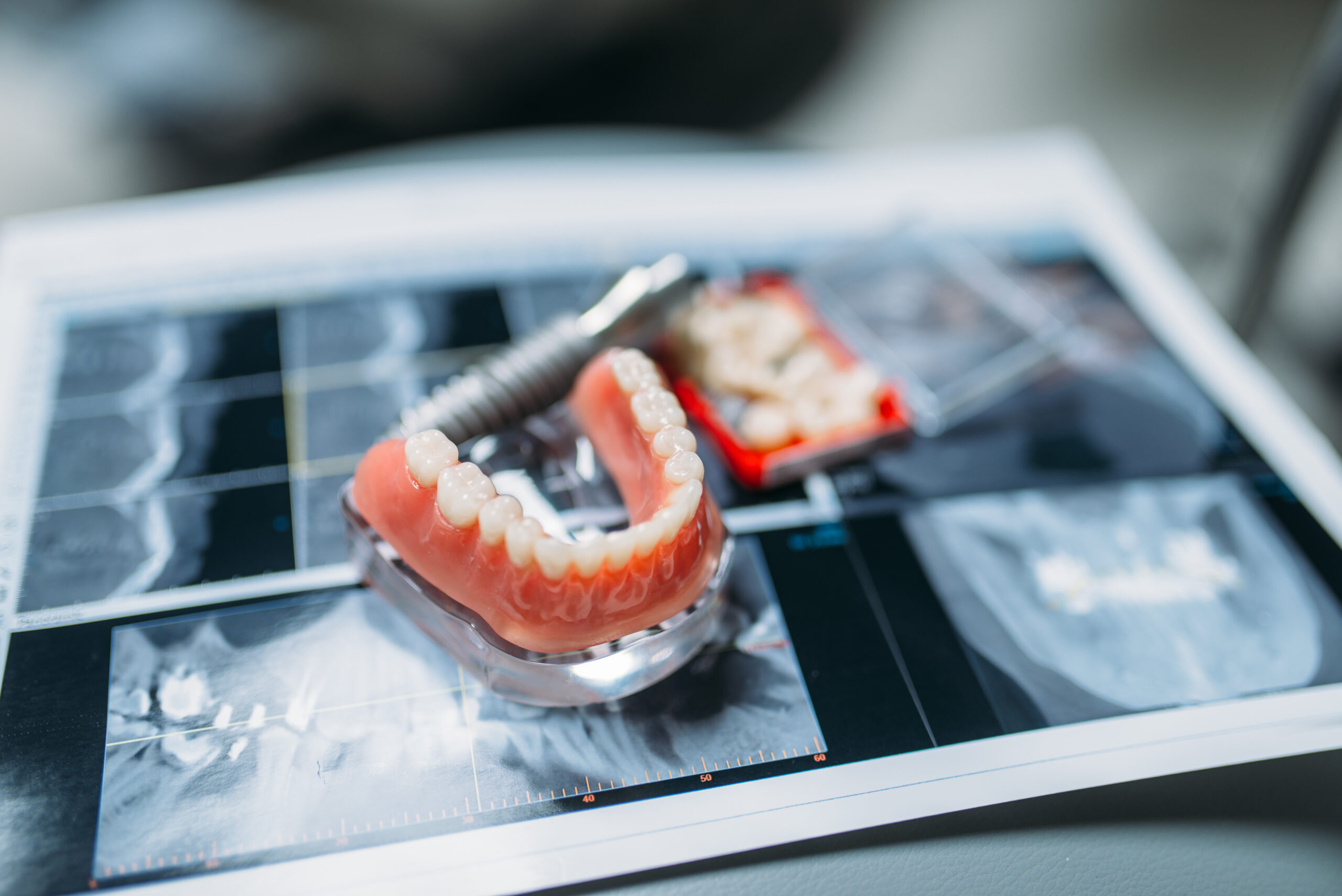 Dentures and pins on the table, dental prostheses