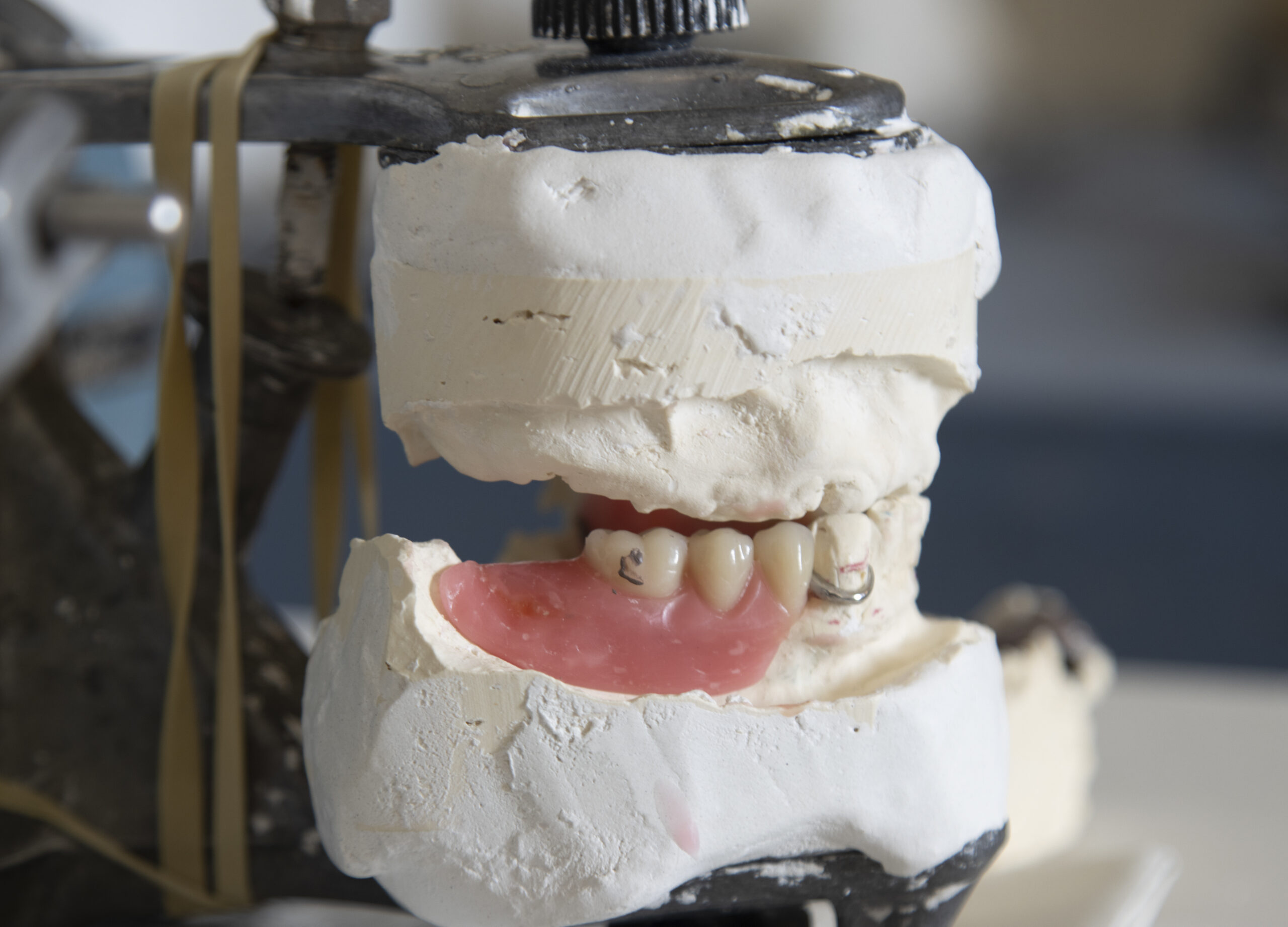 Shot of dental impression molds for reconstruction
