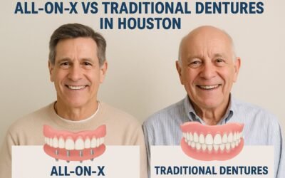 All-on-X vs Traditional Dentures in Houston: How to Choose the Right Option