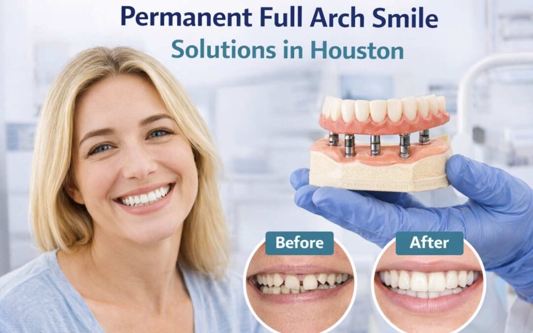 Permanent Full Arch Smile Solutions in Houston