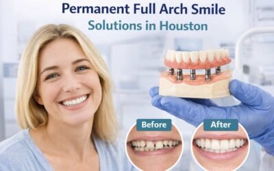 Permanent Full Arch Smile Solutions in Houston