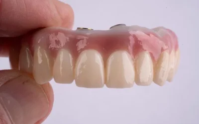 Why Affordable Dental Implants in Houston Are a Popular Choice for Patients