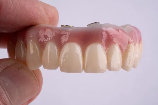 Why Affordable Dental Implants in Houston Are a Popular Choice for Patients Why Affordable Dental Implants in Houston Are a Popular Choice for Patients